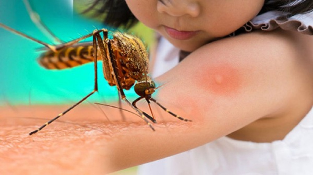 श्रीलङ्काका ५० हजारभन्दा बढीमा डेंगुको प्रकोप, ४३ वटा क्षेत्र उच्च जोखिममा