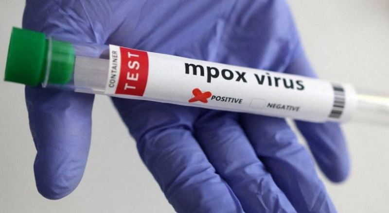 जापानमा पहिलोपटक २० वर्षीया युवतीलाई ‘क्लेड १बी एमपक्स’ भाइरस पुष्टि